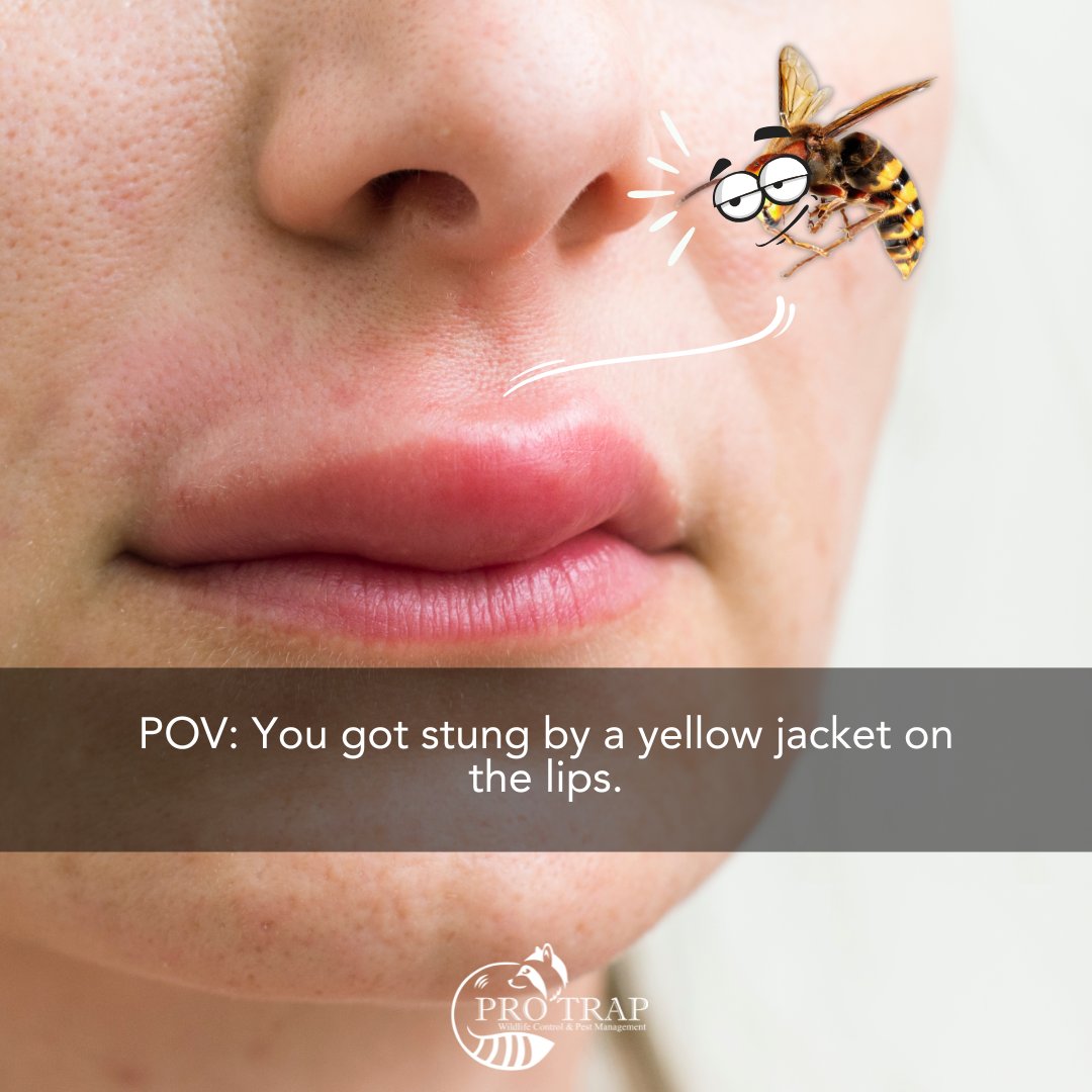 POV: You got stung by a yellow jacket on the lips. Not fun.

Let us help you keep them away: protrap.ca/pest-control