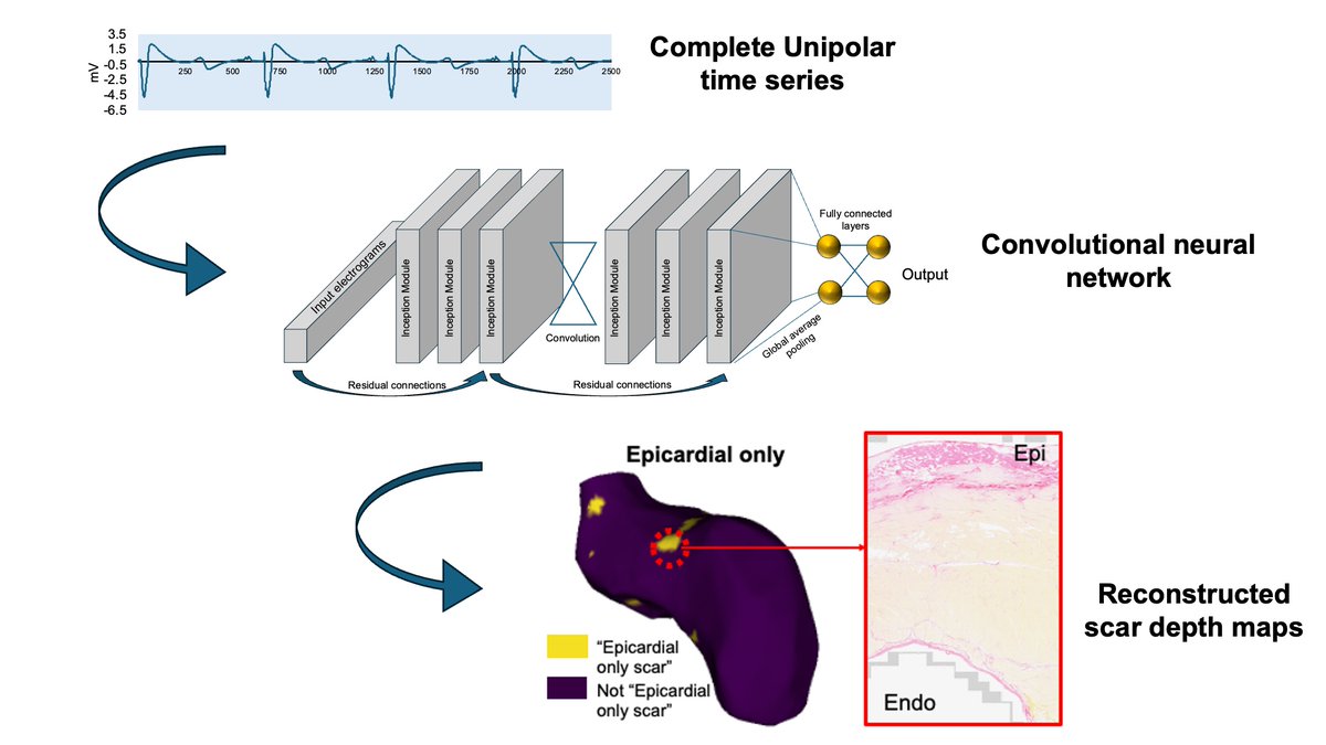 CircEP (@circulationep) on Twitter photo #Epeeps, convolutional neural networked algorithms trained on intracardiac egms can predict ventricular scar; insights from whole heart histology and machine learning <a href="/drashwinb/">Ashwin B</a> <a href="/jameschong_doc/">James Chong</a> <a href="/kasun_de_silva/">Kasun De Silva</a> <a href="/Dr_RobAnderson/">Robert Anderson</a> <a href="/RBennett_EP/">Richard Bennett</a> #AHAJournals doi.org/10.1161/CIRCEP⦠#Epeeps, convolutional neural networked algorithms trained on intracardiac egms can predict ventricular scar; insights from whole heart histology and machine learning <a href="/drashwinb/">Ashwin B</a> <a href="/jameschong_doc/">James Chong</a> <a href="/kasun_de_silva/">Kasun De Silva</a> <a href="/Dr_RobAnderson/">Robert Anderson</a> <a href="/RBennett_EP/">Richard Bennett</a> #AHAJournals doi.org/10.1161/CIRCEPā¦
