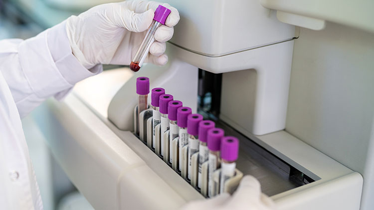 ICYMI: FDA Approves First Blood Test to Diagnose Alzheimer’s. According to BrainFacts/SfN, “Blood tests like this one are important advancements in the effort to diagnose Alzheimer’s as early as possible.” Read More at, brainfacts.org/neuroscience-i…