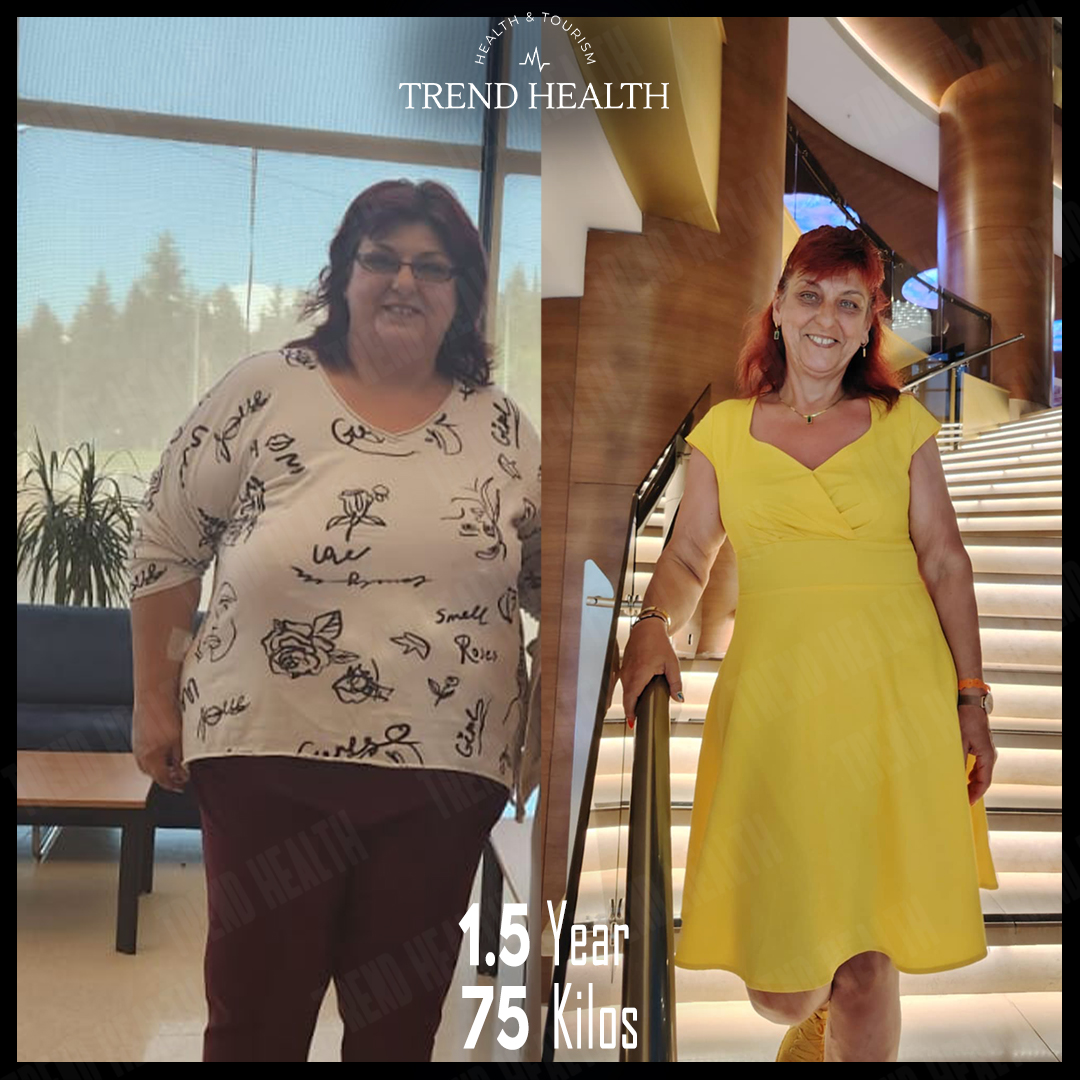 TrendHealthtr's tweet photo. Daniela❤️
#beforeandafter #beforafterweightloss #weightlossjourney #weightlosstransformation #trendhealth https://t.co/vfjD87gQqG