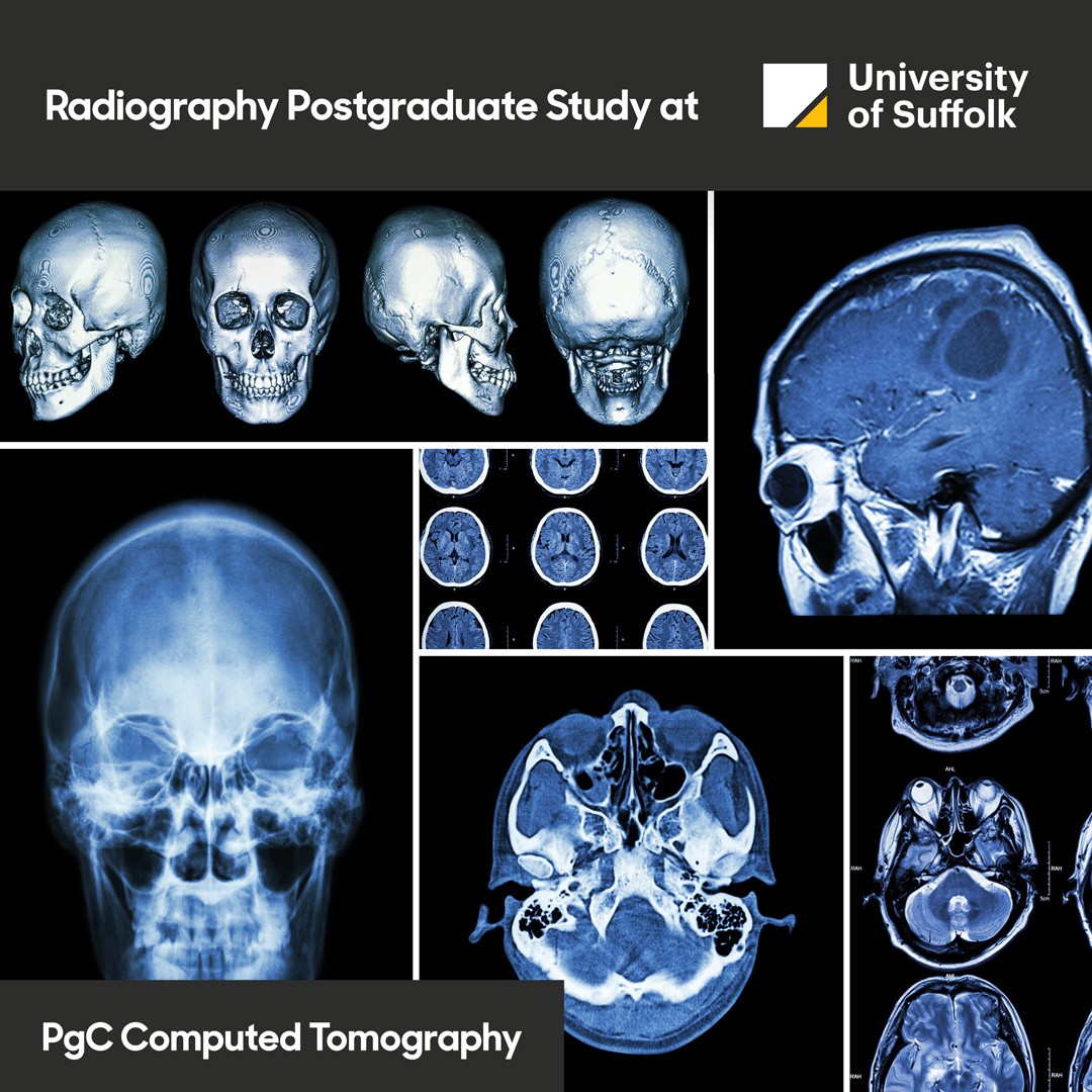 UoS Diagnostic Radiography (@uos_radiography) on Twitter photo Applications are now open to study PgC CT starting Nov 2025. To find more information and to see other postgraduate courses we offer visit: uos.ac.uk/about/academic………… #radiography #postgraduate #CT #radiographer #HelloSuffolk #study #radiology #computed #tomography Applications are now open to study PgC CT starting Nov 2025. To find more information and to see other postgraduate courses we offer visit: uos.ac.uk/about/academic………… #radiography #postgraduate #CT #radiographer #HelloSuffolk #study #radiology #computed #tomography