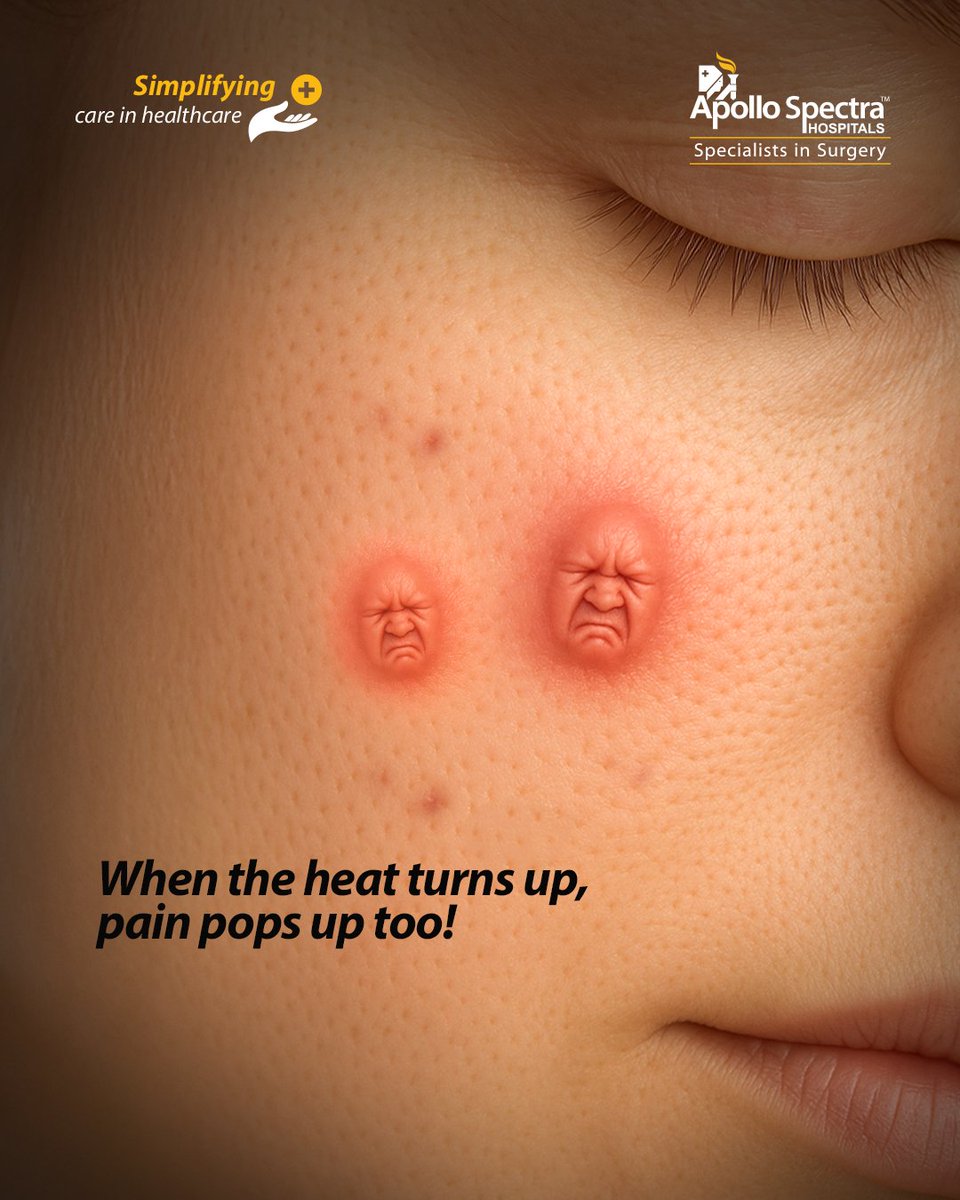 apollospectra's tweet image. Is the heat messing with your skin? 

Be it the blazing summer or humid monsoons, flare-ups and pimples can take a toll. Stay cool, stay fresh, and protect your skin through every season.

#ApolloSpectra #MonsoonSkinCare #PimpleProblems #SkinCareTips #BeatTheHeat