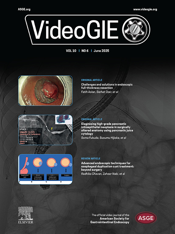 VideoGIE Journal (@videogie) on Twitter photo VideoGIE is looking for its next Editor-in-Chief. CV, statement of interest and vision, and conflict of interest disclosure are due July 15. The most qualified candidates will be invited to submit a comprehensive application and interview. Email videogie@asge.org for details. VideoGIE is looking for its next Editor-in-Chief. CV, statement of interest and vision, and conflict of interest disclosure are due July 15. The most qualified candidates will be invited to submit a comprehensive application and interview. Email videogie@asge.org for details.