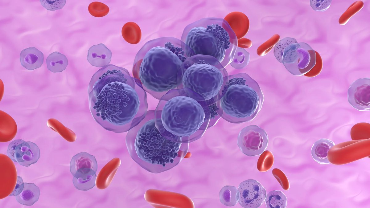 Albert Einstein College of Medicine - Official (@einsteinmed) on Twitter photo Einstein Research led by <a href="/mkonople/">Marina Konopleva</a>: Possible New Treatment for Form of Acute Myeloid #Leukemia
Learn more at bit.ly/4n1a1eV. Einstein Research led by <a href="/mkonople/">Marina Konopleva</a>: Possible New Treatment for Form of Acute Myeloid #Leukemia
Learn more at bit.ly/4n1a1eV.