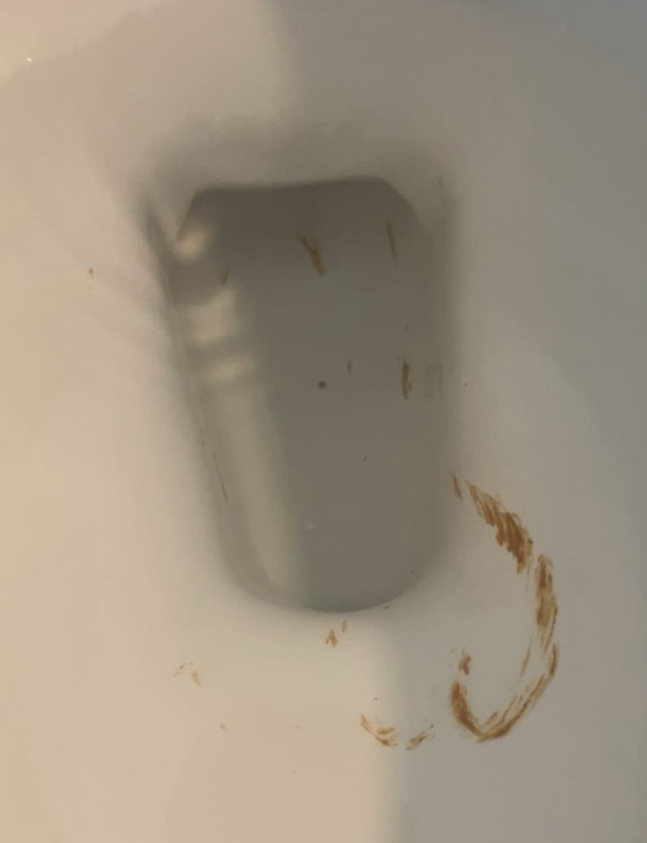 jethrowilbur's tweet photo. I call this one “The Fish Hook” https://t.co/Sa7Q3HAGqM