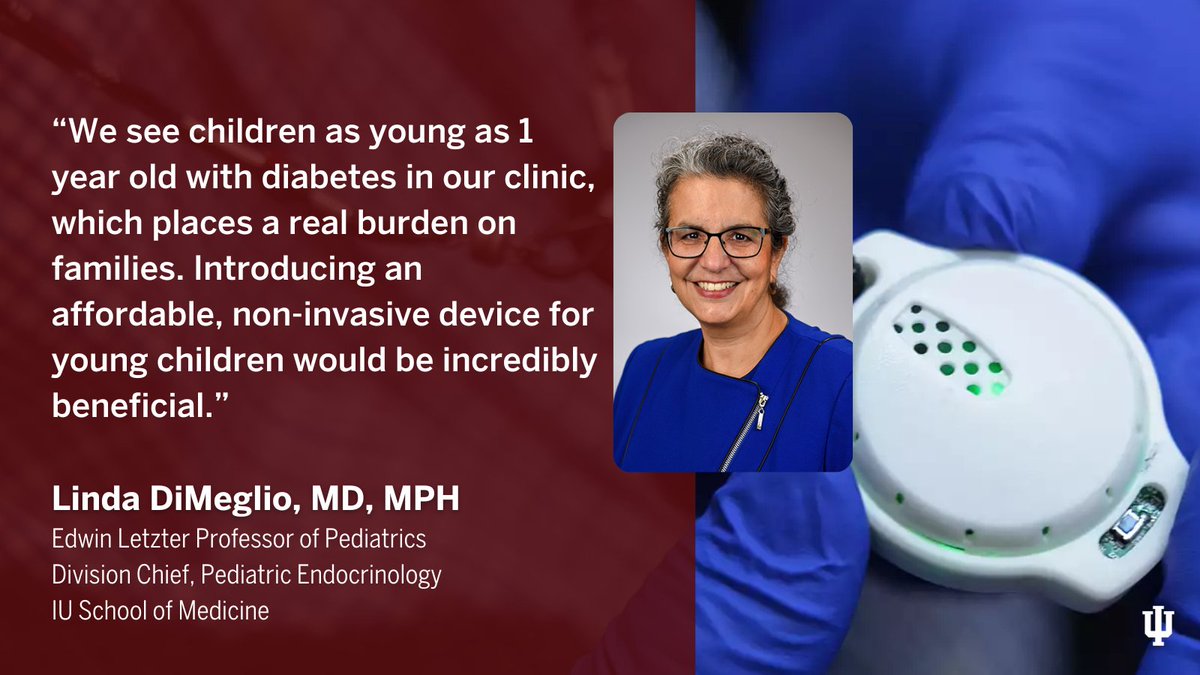 IU Department of Pediatrics (@iudeptpeds) on Twitter photo An <a href="/IUMedSchool/">IU School of Medicine</a> clinical trial, under guidance from Linda DiMeglio, MD, MPH, will test a breathalyzer device for its accuracy in monitoring blood sugar — a vital step in finding better alternatives for children and those at risk for #Type2diabetes.
More: go.iu.edu/8tEq An <a href="/IUMedSchool/">IU School of Medicine</a> clinical trial, under guidance from Linda DiMeglio, MD, MPH, will test a breathalyzer device for its accuracy in monitoring blood sugar — a vital step in finding better alternatives for children and those at risk for #Type2diabetes.
More: go.iu.edu/8tEq