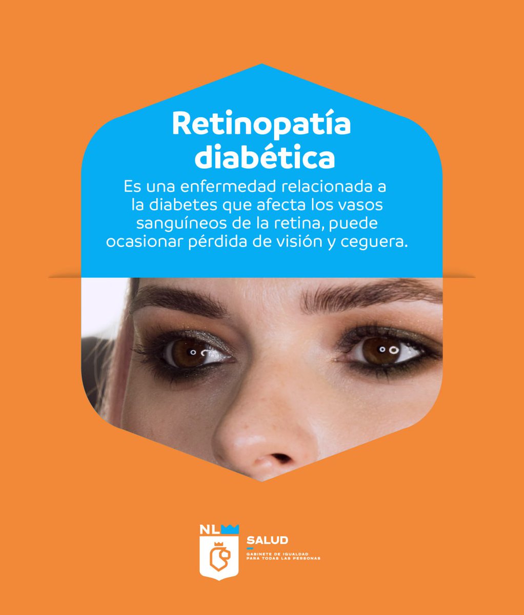 La diabetes también puede afectar tu vista. 👁️⚠️
La retinopatía diabética es una de las principales causas de ceguera en adultos.

Si vives con diabetes, hazte revisiones oftalmológicas al menos una vez al año. Ver claro también es salud. 🩺💙
