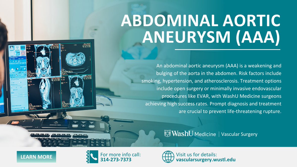 Our WashU Medicine vascular team is transforming abdominal aortic aneurysm (AAA) care with minimally invasive procedures, ensuring faster recovery and remarkable patient outcomes. 

Discover more about our innovative approach: bit.ly/3Fl4u1V
#WashUMedicine #WashUSurgery