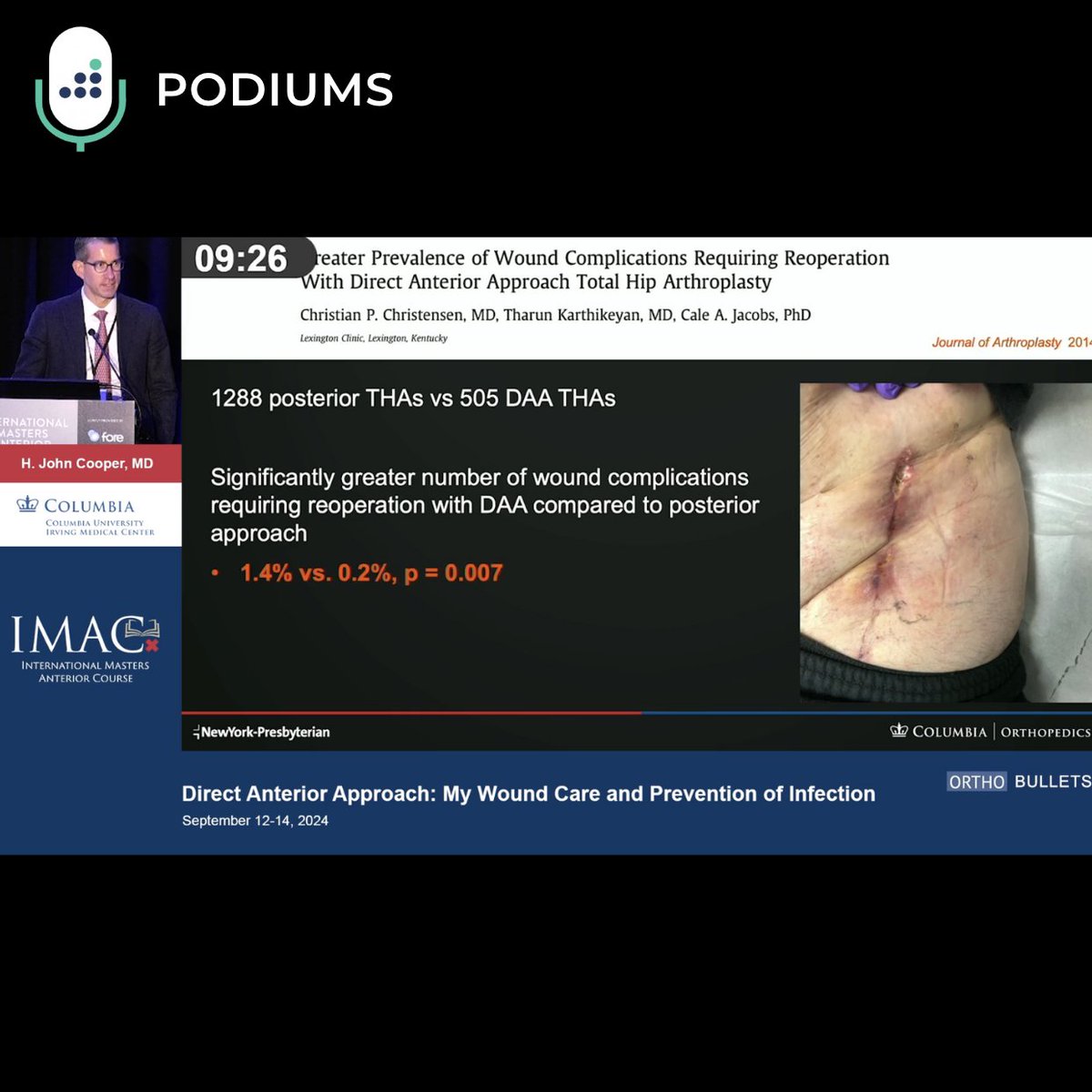 Welcome to Season 2 of the Orthobullets Podcast

Today's Podiums episode will focus on the talk given by Dr. John Cooper, and is titled "Direct Anterior Approach - My Wound Care and Prevention of Infection".

Listen to the entire talk on our DAILY Orthobullets podcast. Listen