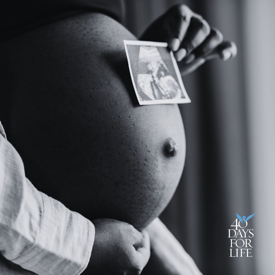 40daysforlife's tweet photo. This is not just a picture—it’s a glimpse of a soul already known and loved by God.
From the moment of conception, this life is sacred. 💕 #MadeInHisImage #ProLife https://t.co/04BdouEa1l