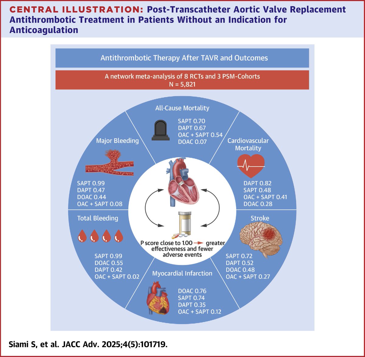 This comprehensive network meta-analysis of 11 studies (8 RCTs and 3 PSM cohorts) comparing various antithrombotic strategies recommends SAPT as the safest antithrombotic therapy for pts without an indication for #anticoagulation post-#TAVR. jacc.org/doi/10.1016/j.… #JACCAdvances