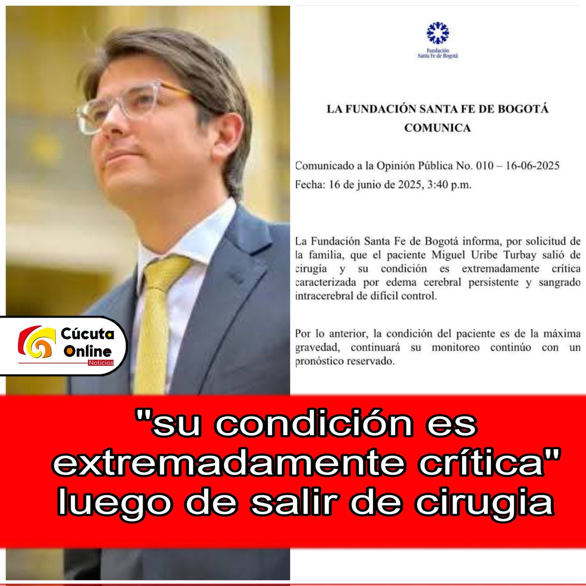 La <a href="/FSFB_Salud/">Fundación Santa Fe de Bogotá</a> informó que Miguel Uribe Turbay fue sometido a cirugía y su estado es extremadamente crítico. El comunicado médico indica que presenta edema cerebral persistente y sangrado intracerebral de difícil control ysu condición esde máxima gravedad #Colombia #FuerzaMiguel