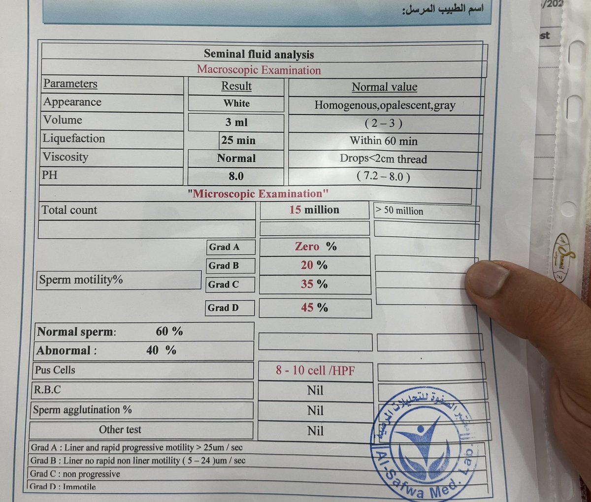Sa10m94's tweet photo. @ryousifacu دكتوره حالتي بهذا التحليل حسب الطبيب الاستشاري ان عندي التهاب قوي بالمسالك البولية مما ادى الى عدم تحرك الحيوانات المنوية وجهلها مقيدة بنسبة صفر هل هناك وصفه طبيعية وجزاك الله عني خير الجزاء https://t.co/JCBz43UdbP