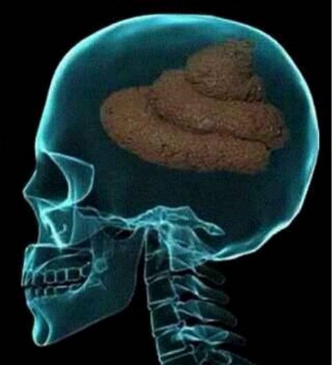 #LaMarchaPorTodos #Feinmann #NO LO PUEDO CREER

El kircho es tan pobre infeliz que vive en una villa y apoya a una hija de puta que tiene 1.000 millones de dólares robados!!
Compraban electrodomésticos en 12 cuotas y ahora dan la vida por una chorra!!
Tomografía de un Kircho!!