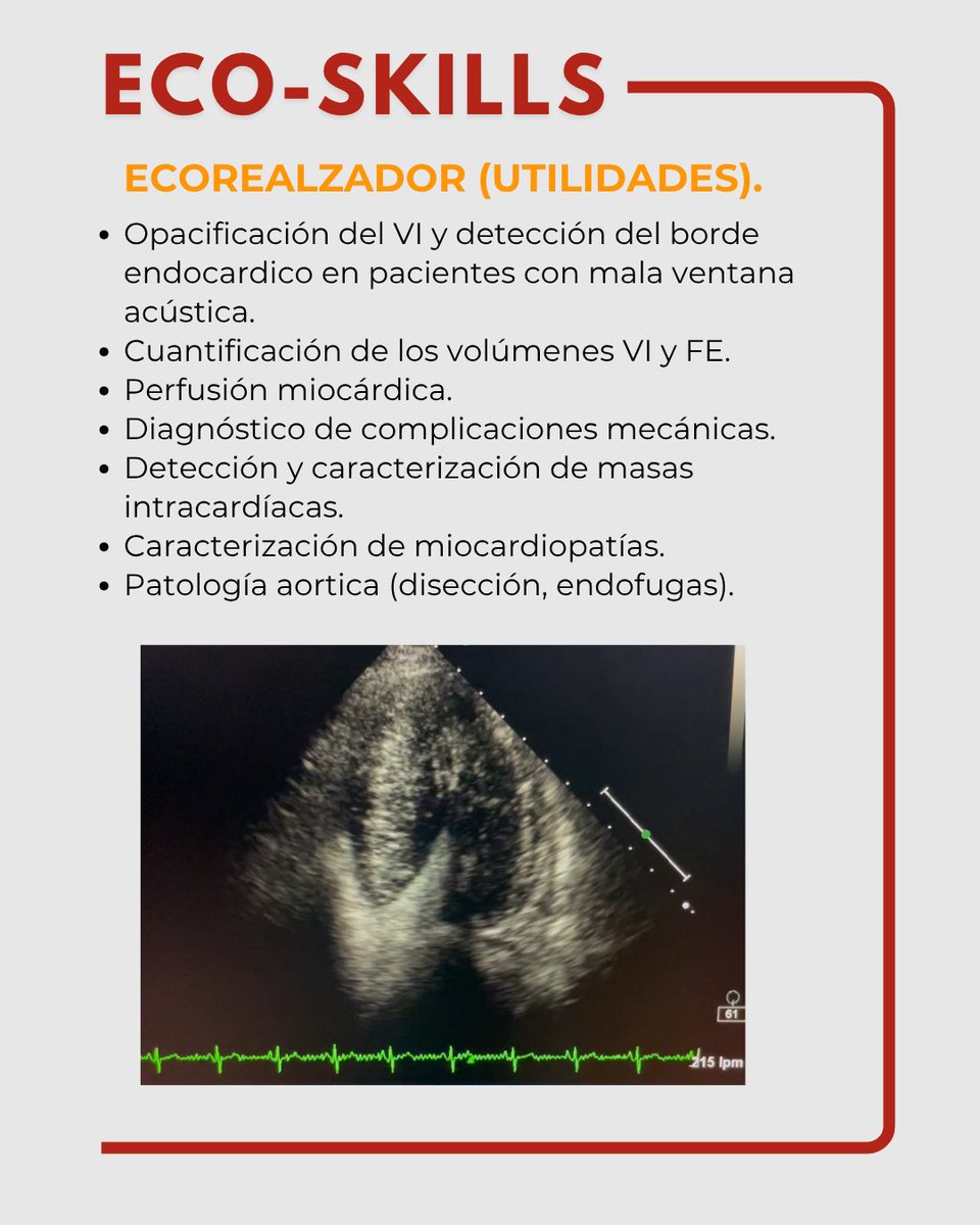 Ecorealzador
Optimiza tu diagnóstico en pacientes con mala ventana acústica.
Permite una mejor visualización del VI, cuantificación de volúmenes y FE, evaluación de perfusión miocárdica, detección de masas, miocardiopatías y patología aórtica.
#EcoSkills #Ecocardiografía