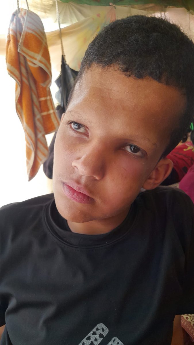 This is what Ahmed became after he suffered from inflammation in his upper jaw and toothache, and he needs a surgery that is expensive for us. Every small donation makes a difference. 
chuffed.org/project/126582…