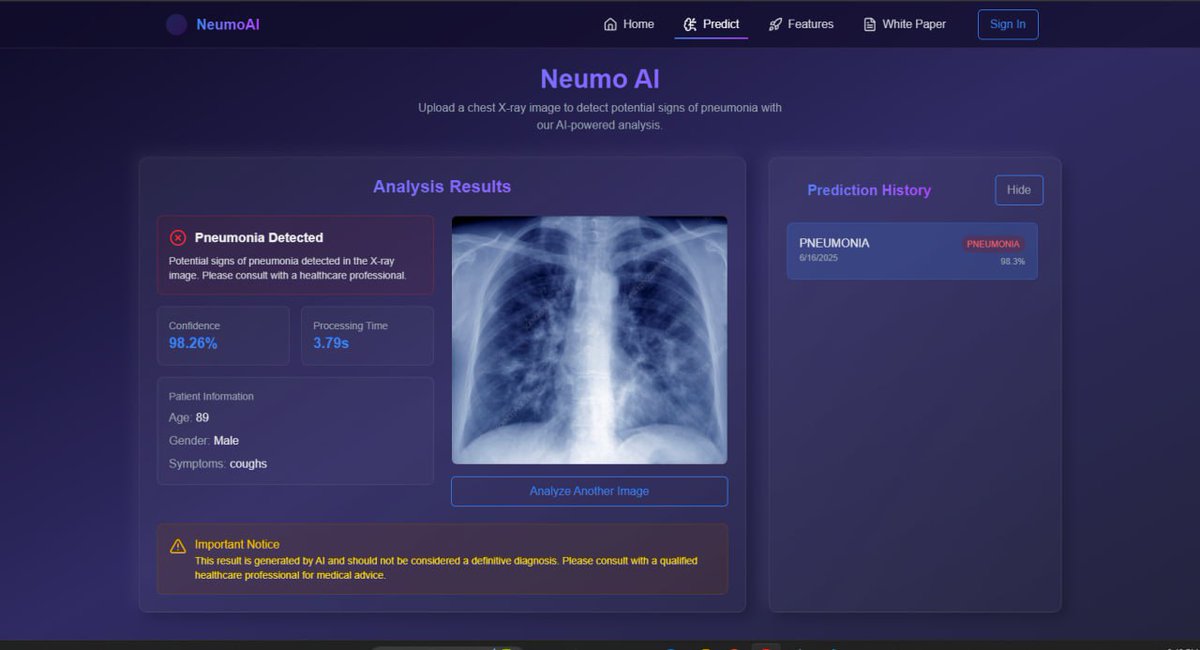 arnold0duor's tweet image. Pneumonia Detection using custom CNNs

🚀🚀Now online

neumoai.netlify.app