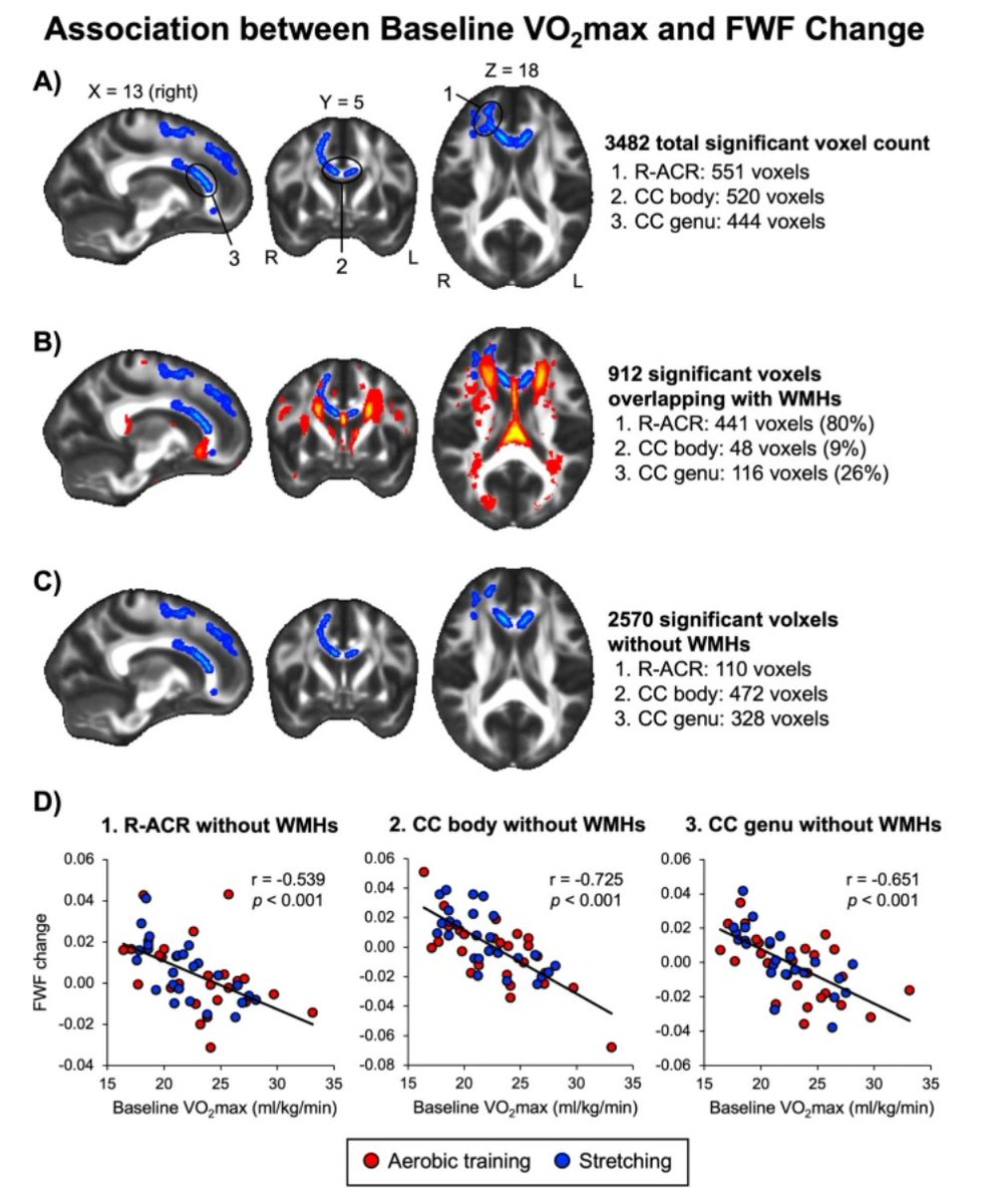 GeroScienceAGE's tweet photo. 📢New Open🔓 Access Paper in GeroScience

Effects of aerobic exercise and cardiorespiratory fitness on white matter free water fraction in older adults: a 1-year randomized controlled trial by Takashi Tarumi & Rong Zhang et al.

https://t.co/Al9GCGoJ1X

#aerobicexercise #cardiorespiratoryfitness #whitematter #cognitivefunction