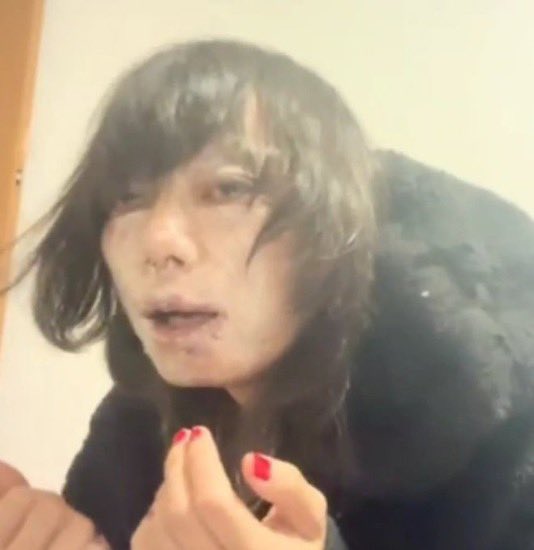 Daily Hiro⛑️🔪 (@HiroKunDaily) / Posts / X