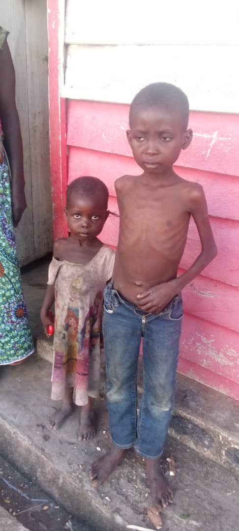Sharangabo Léopold (@sharangaboleop1) on Twitter photo En cette Journée dédiée à l’enfant #africain, pensons aux enfants réfugiés du camp de #Lusenda, en RDC victimes du kwashiorkor.
Ces #enfants et leurs familles viennent de passer #cinq mois sans aucune assistance humanitaire. Le #HCR a quitté les lieux, les laissant seuls face à En cette Journée dédiée à l’enfant #africain, pensons aux enfants réfugiés du camp de #Lusenda, en RDC victimes du kwashiorkor.
Ces #enfants et leurs familles viennent de passer #cinq mois sans aucune assistance humanitaire. Le #HCR a quitté les lieux, les laissant seuls face à