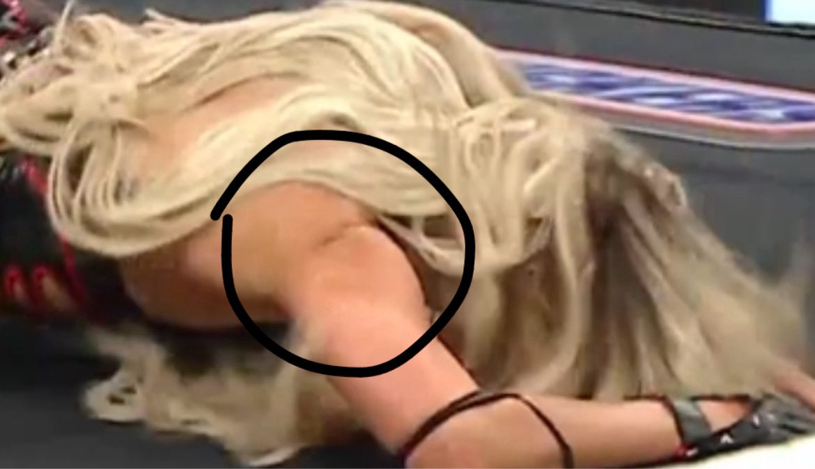 Liv Morgan's shoulder dislocated in the ring!

#WWERaw