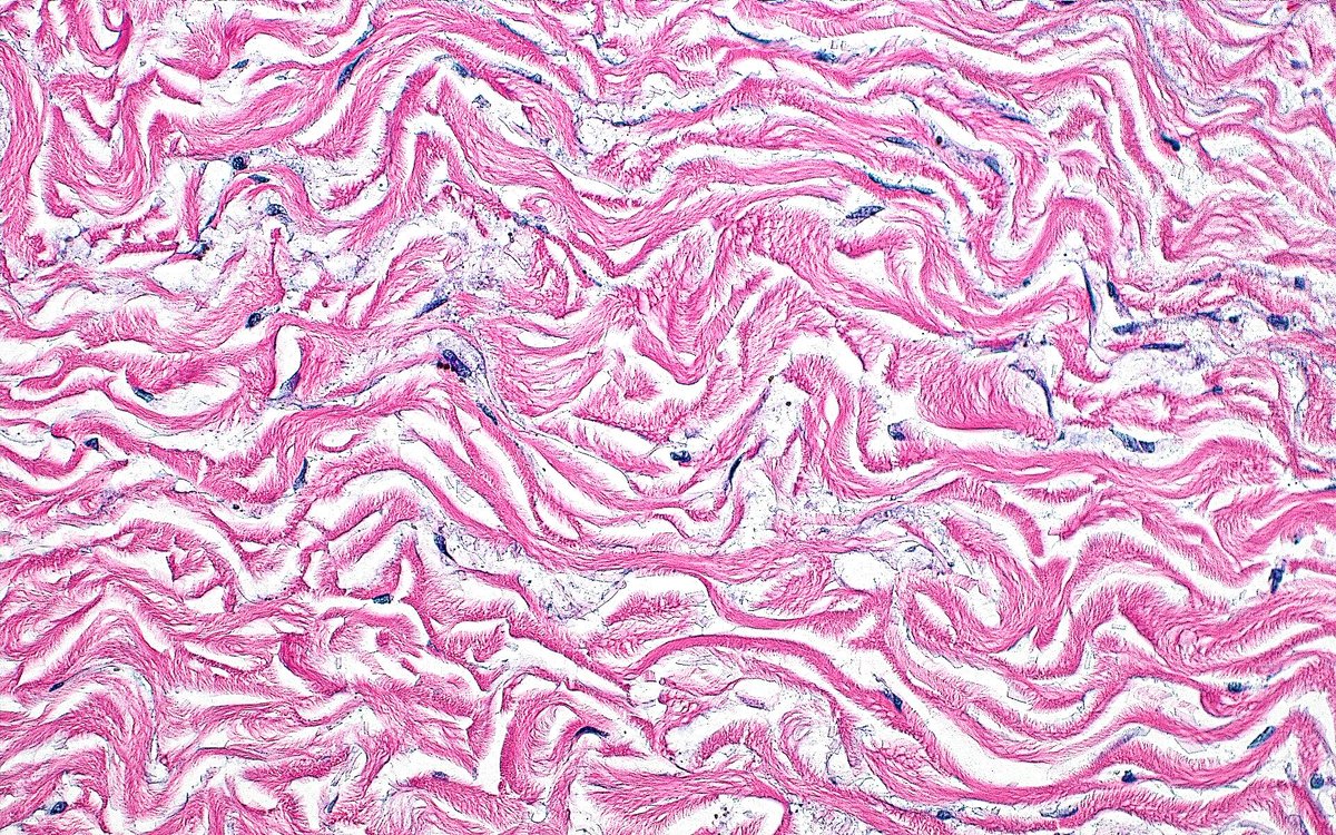 ziad_zaatari's tweet image. 🔬 Collagen Fibers ~ From the adventitia of the aorta ~ #PathArt 🎨📸