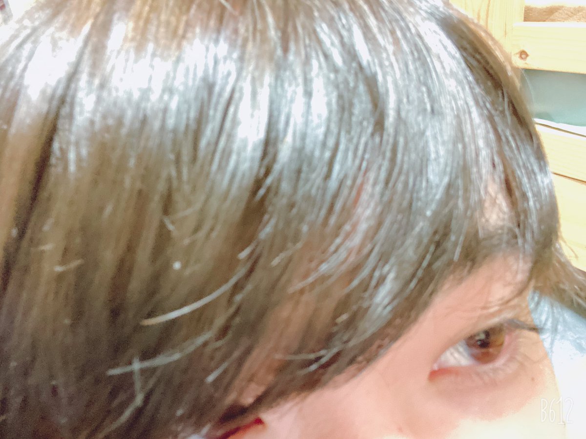 ここでまつ毛の長さをみてみましょう