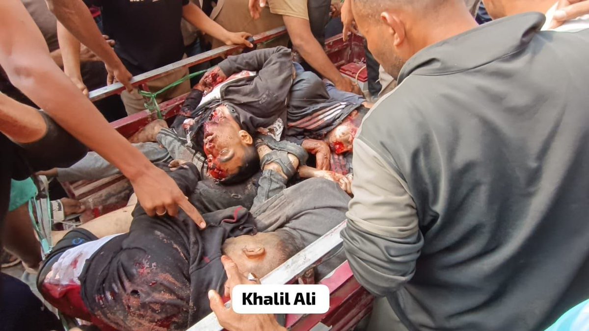 AnasAlSharif0's tweet photo. هذه دماؤنا وأشلاؤنا، نحن أهلكم وإخوانكم.
أين العرب؟ أين المسلمون؟ أين العالم من هذه المجازر؟! https://t.co/afiSHNWY6z