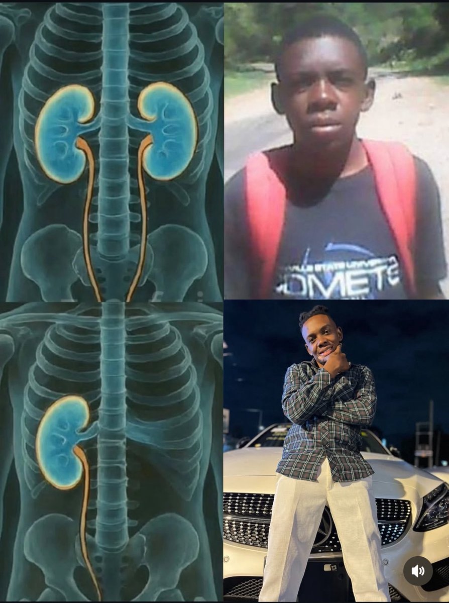 Utaamua wewe 😂😂😂😂