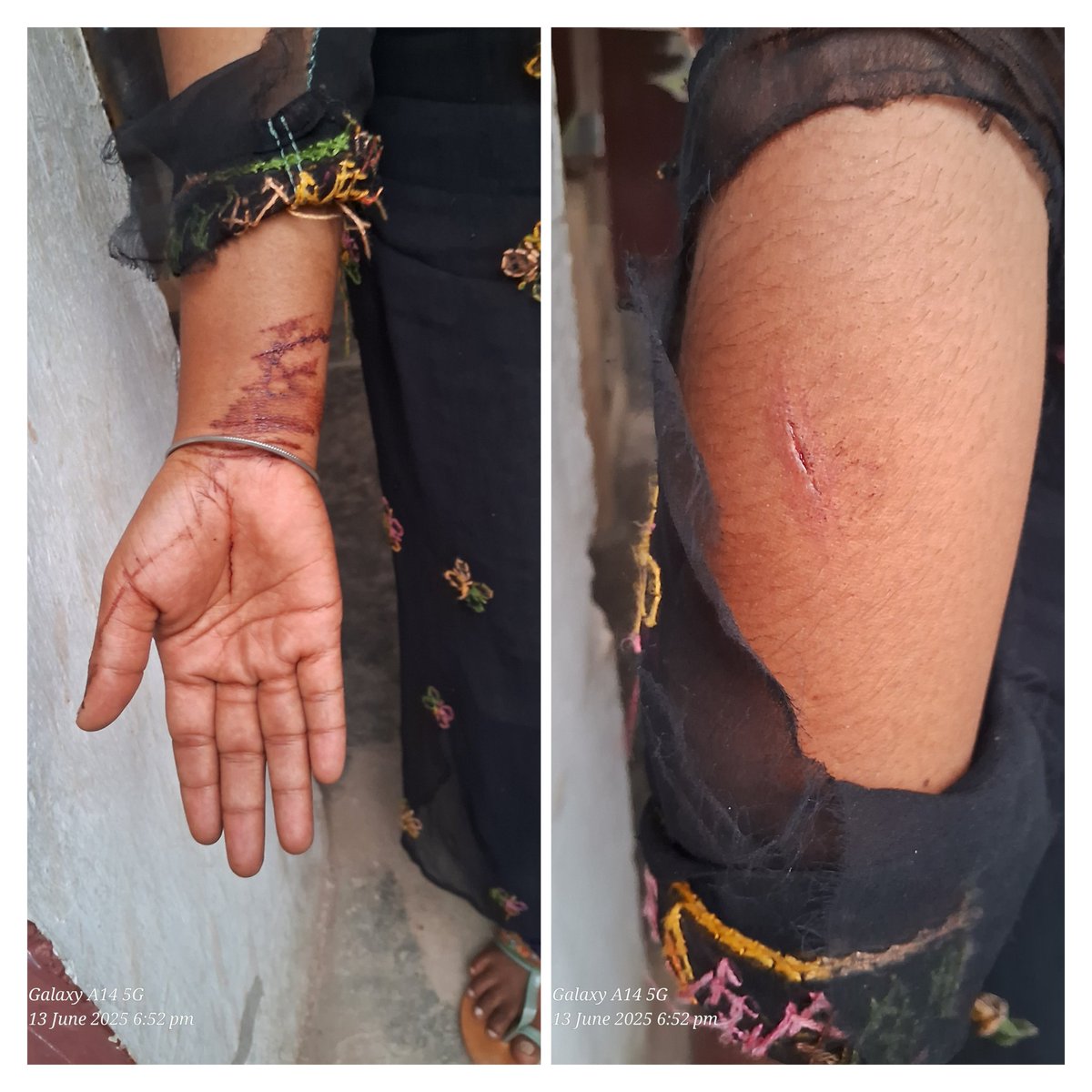 CHATKARAUP's tweet image. #फतेहपुर 
घर में घुसकर अकेली युवती से की मारपीट, मोबाइल छीना, #SPFHR को प्रार्थना पत्र भी दिया। पीड़िता को आए रोज दरवाजे चढ़कर धमकाते आरोपी, #बिन्दकी पुलिस की कार्यवाही शून्य??
@UPGovt 
@Uppolice 
@ADGZonPrayagraj 
@igrangealld 
@dmfatehpur 
@fatehpurpolice 
@AjaiBhadauriya