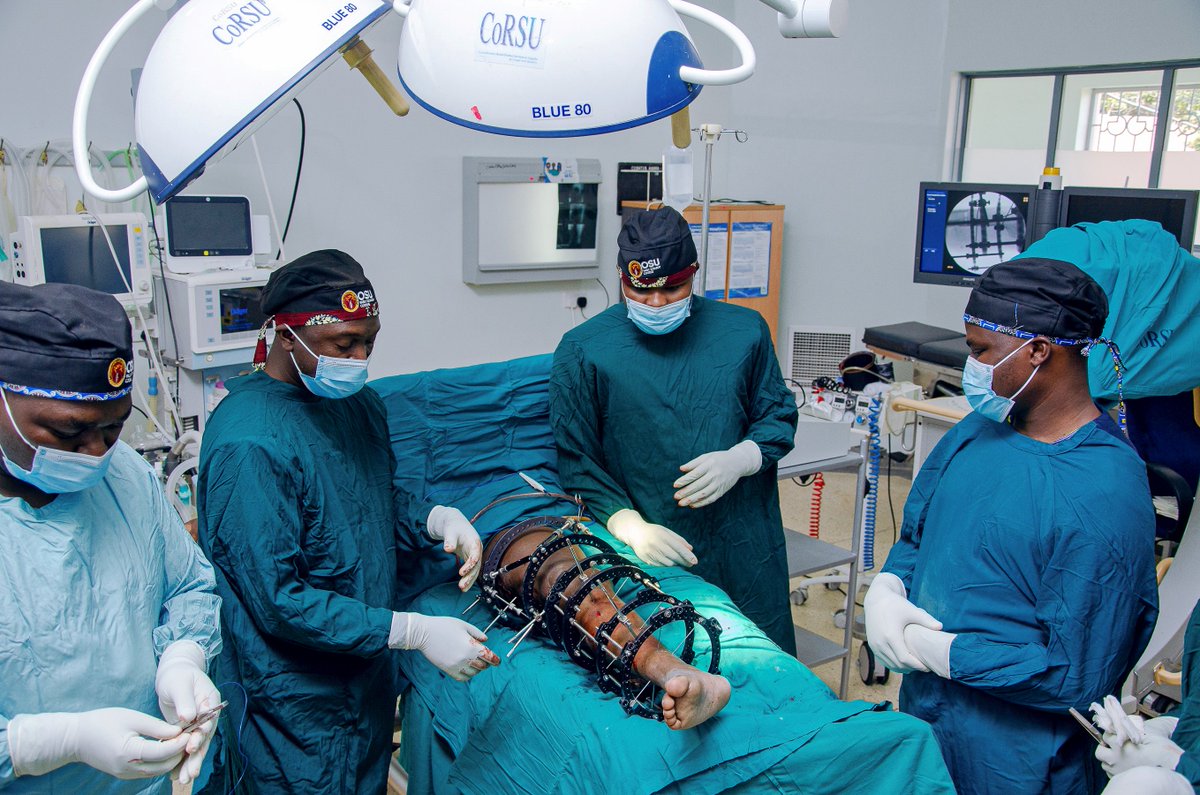 At the OSU Basic Ilizarov Course 2025, we combined the simulation sessions with a realtime onsite and broadcasted Surgery at <a href="/corsuhospital/">CoRSU</a> 

Applied both a Taylor Spatial frame and Ilizarov frame for Correction of a femur malunion with external rotation and Limb shortening.