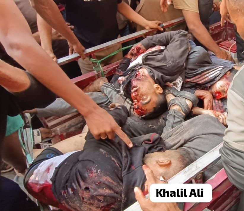 خبر مش مهم للعالم الظالم
حصيلة مجزرة الاحتلال بحق المواطنين الذين ينتظرون المساعدات في منطقة التحلية بمحافظة خان يونس صباح اليوم، حتى اللحظة 51 شهيد وأكثر من 200 اصابة بينهم 20 حالة خطيرة جداً.

وزارة الصحة بغزة
17يونيو2025