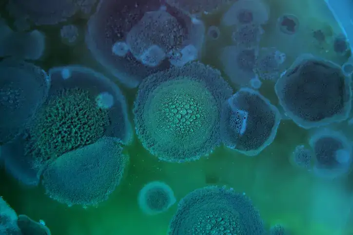ETHealthWorld's tweet photo. Not a virus or bacteria, but this silent killer is spreading and climate change is helping it thrive
#virus | #bacteria | #climate_change | #infection | #fungus | #mold | #diagnosis | #public_health | #healthcare | #aspergillus
Read more:
https://t.co/8QuC0nv4iL https://t.co/gay7iwHmFo