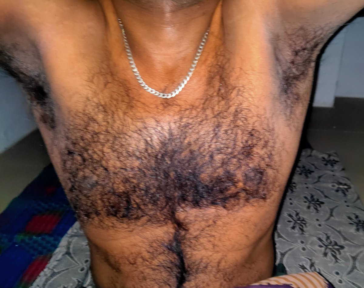 A casual click for pits 😉