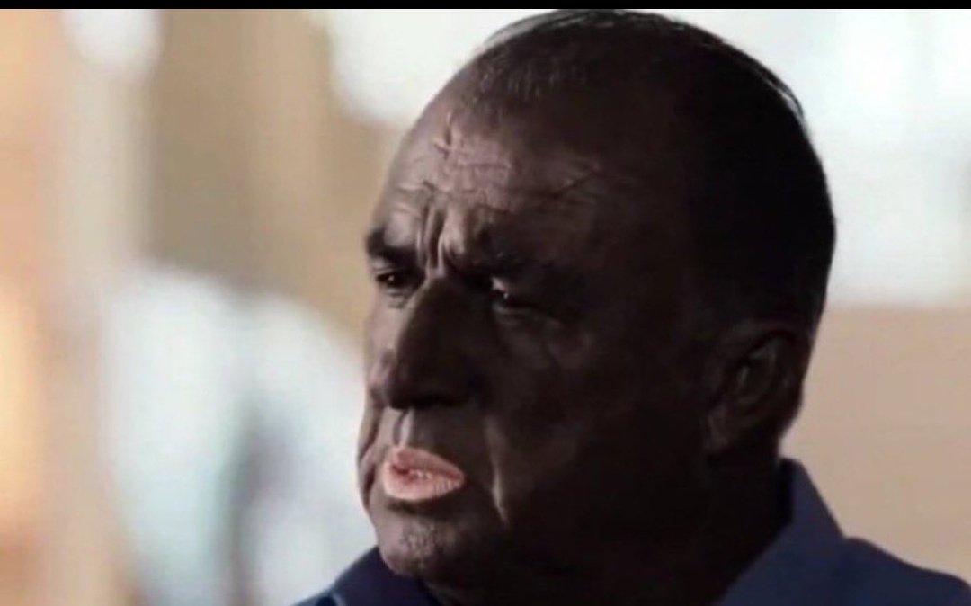 amık bi deri pigmenti kararmaya neden bu kadar istekli olur ki güneş ışığı değer değmez şuna dönüyoruz yaa