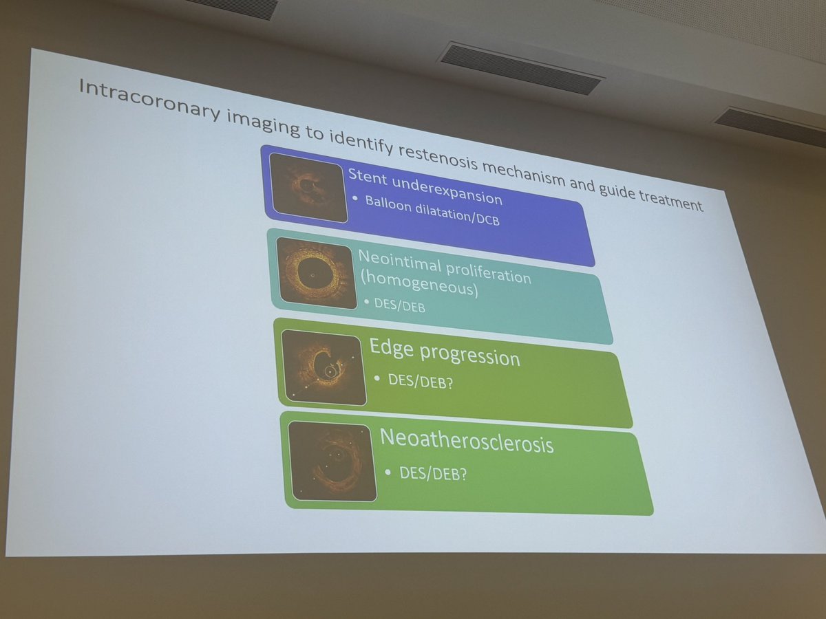 Belén Cid Alvarez (@belcid7) on Twitter photo VI Madrid DCB Meeting 📚
📌Learning about drug coated balloon coronary therapy from leading national and international experts #HospitallaPrincesa
<a href="/shci_sec/">ACI-SEC: Hemodinamica</a> <a href="/NievesGonzalo1/">Nieves Gonzalo</a> <a href="/teresabastante/">Teresa Bastante</a> <a href="/OjedaOjeda18/">Soledad Ojeda</a> <a href="/JuradoRomanAl/">Alfonso Jurado-Román</a> <a href="/maitevelazquezm/">maite velazquez martin</a> <a href="/fer_iver/">Fernando Rivero</a> <a href="/paulantun/">Paula Antuña</a> <a href="/PCRonline/">PCRonline 🫀</a> VI Madrid DCB Meeting 📚
📌Learning about drug coated balloon coronary therapy from leading national and international experts #HospitallaPrincesa
<a href="/shci_sec/">ACI-SEC: Hemodinamica</a> <a href="/NievesGonzalo1/">Nieves Gonzalo</a> <a href="/teresabastante/">Teresa Bastante</a> <a href="/OjedaOjeda18/">Soledad Ojeda</a> <a href="/JuradoRomanAl/">Alfonso Jurado-Román</a> <a href="/maitevelazquezm/">maite velazquez martin</a> <a href="/fer_iver/">Fernando Rivero</a> <a href="/paulantun/">Paula Antuña</a> <a href="/PCRonline/">PCRonline 🫀</a>