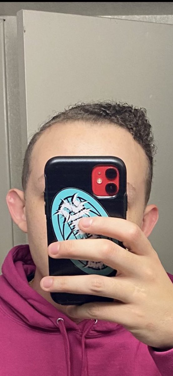 KyleeTaylor19's tweet photo. @LordTowne @NFL_DovKleiman Focus on fixing that hairline first 😮‍💨 https://t.co/Pe3H3M2foL