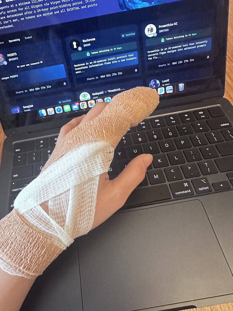 Thank you everyone for checking in and the good wishes! 

I can't reply much, it exhausts my hand😅 but soon i will be back FULL BLOOD.

Doctor said I grinded too hard and broke my hand.
( joking of course🫤)

but I'm literally in 'CoolDown' mode now, typing with 1 hand.

Neva