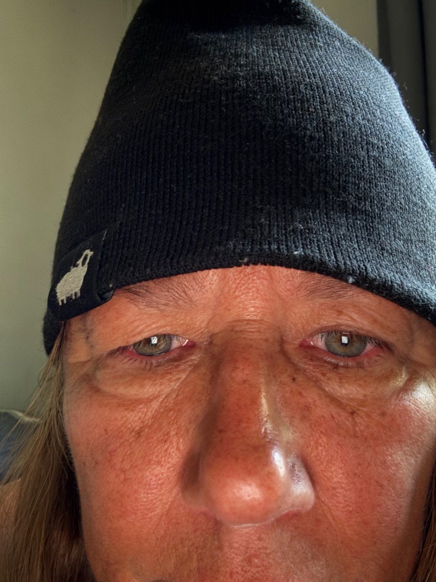 lisakjunker's tweet image. Good morning 
Rough night
#emf 
#infrasound
#dew
#Cybertorture
#SilentHolocaust
#CrimesAgainstHumanity 
#History 
#diary
🇺🇸 🌎 🙏