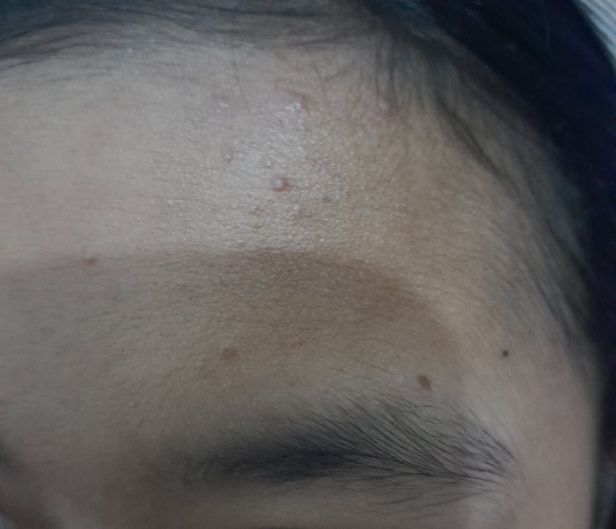 shevaudrey_'s tweet photo. ini cara hilangin nya gmna.... https://t.co/ZJzmsyfa1l