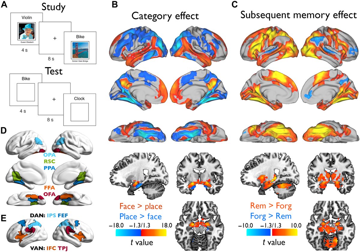 New research suggests that protein pathologies related to Alzheimer’s disease and age-related changes in top-down or voluntarily directed attention can affect neural selectivity in cognitively unimpaired people. scim.ag/4mXz8iG
