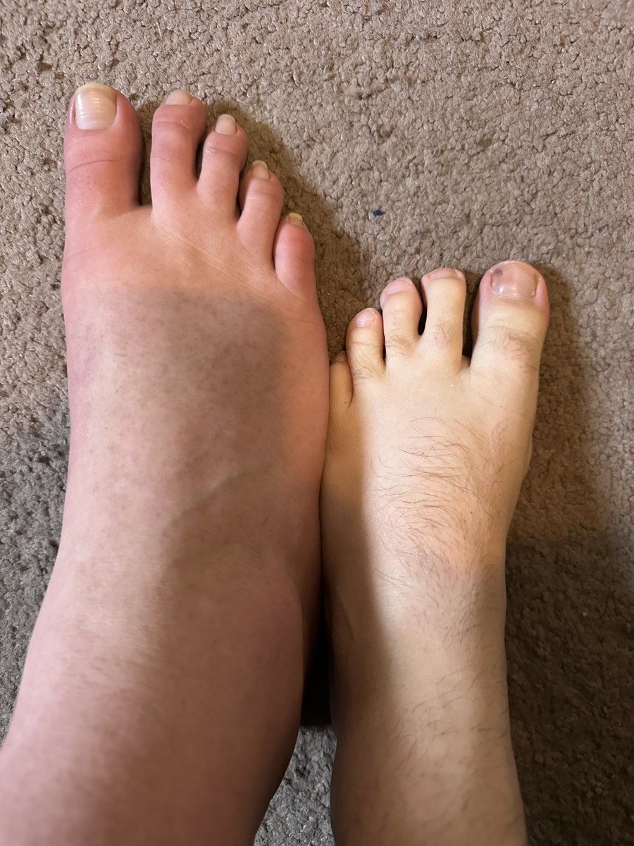 ColossusFeet's tweet photo. My sub is 5’8 with size 9.5 feet. I’m seeing him today so videos are coming very soon. Comment what you want to see https://t.co/w0bMpGKLg6