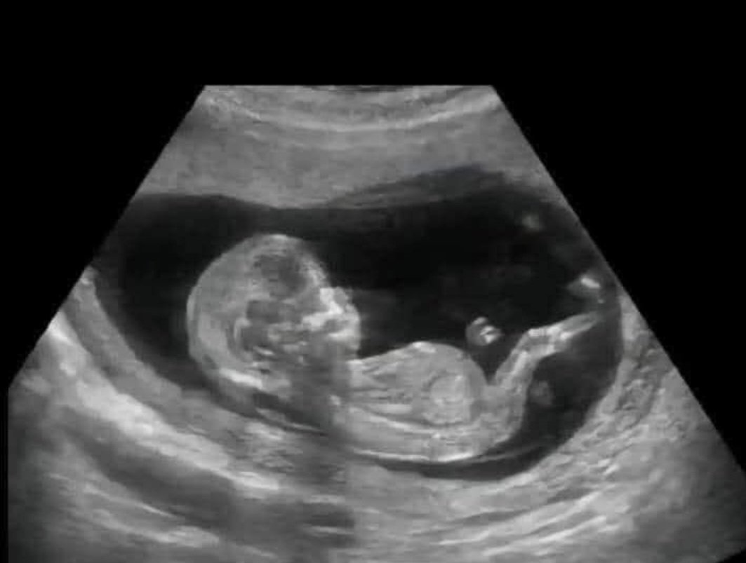 Foto van toen ik mij had moeten inschrijven bij de woningbouwvereniging.