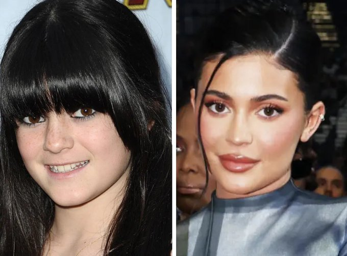 Ünlülerin ünlü olmadan önceki ve sonraki halleri 🧵

1. Kylie Jenner