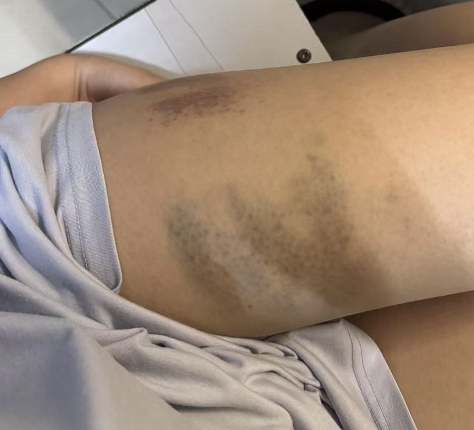 伤痛是我们之间唯一的羁绊