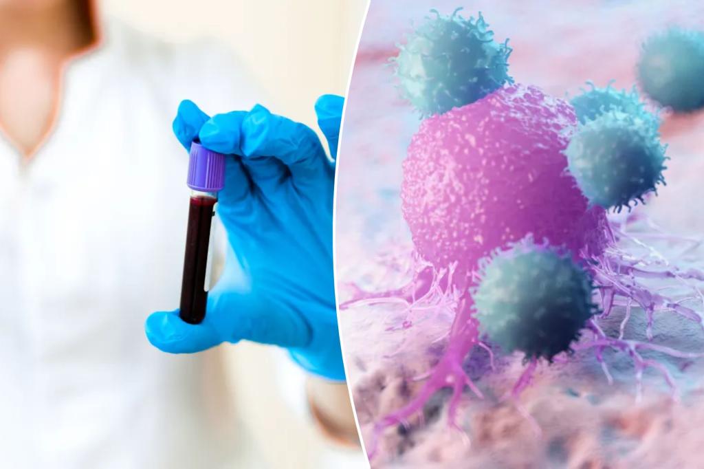 New blood test can detect cancer 3 years before you start showing symptoms trib.al/phpyjkC