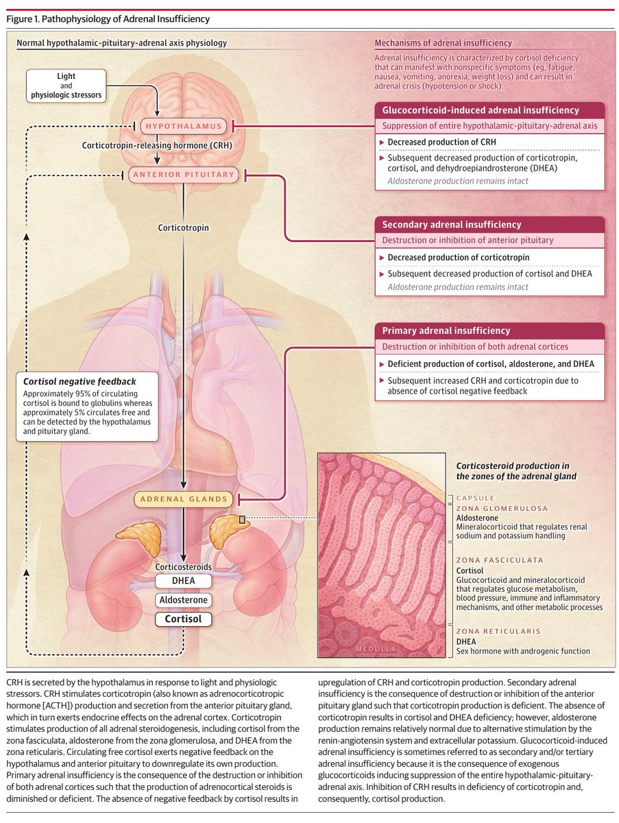 MHcsba's tweet photo. JAMA 2025: Insuficiencia suprarrenal
doi:10.1001/jama.2025.5485
#MedEd #MedTwitter #MedX https://t.co/Kk3OHh5zyc