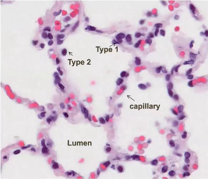 EPID_Separ's tweet photo. La I en #EPID:
El #intersticio es el espacio que separa la membrana basal de los neumocitos alveolares de la membrana basal del endotelio de los capilares sanguíneos. https://t.co/ZbpU8kmHnP