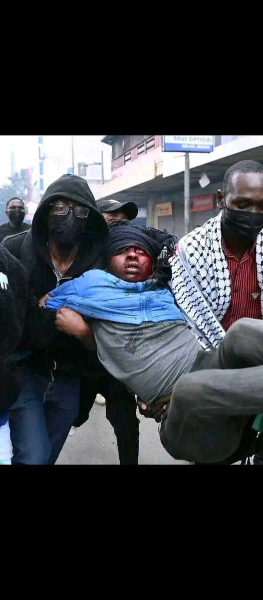 our hearts are bleeding 💔😥😥.Why handle us like criminals ?.we are just trying to save our country from the hands of killers and thieves .we are trying to create a bright future for our children .
#stopkilling us
#stoppolicebrutality