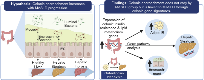 ajpgi's tweet image. Check out today&apos;s #OpenAccess #ArticleinPress from AdventHealth! #Microbiota encroachment and a gut-adipose-liver axis in metabolic dysfunction-associated steatotic #liver disease (Daria Igudesman et al.):

ow.ly/8bIR50WaOm0